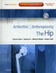 Arthritis And Arthroplasty: The Hip. Text With Dvd And Internet Access Code For Expert Consult Edition